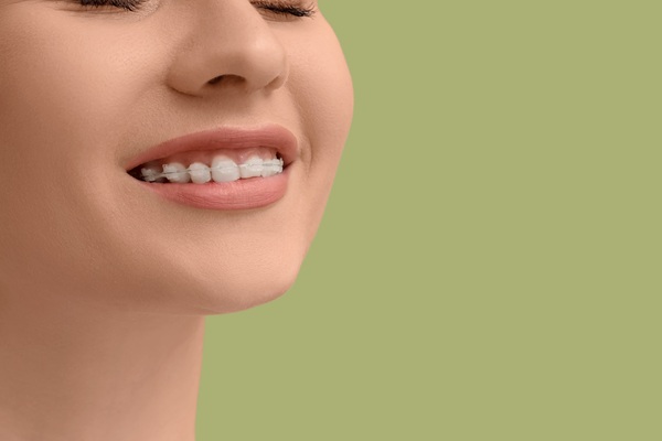 The Pros And Cons Of Clear Braces