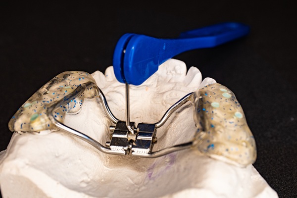What Are The Benefits Of Orthodontic Expanders?
