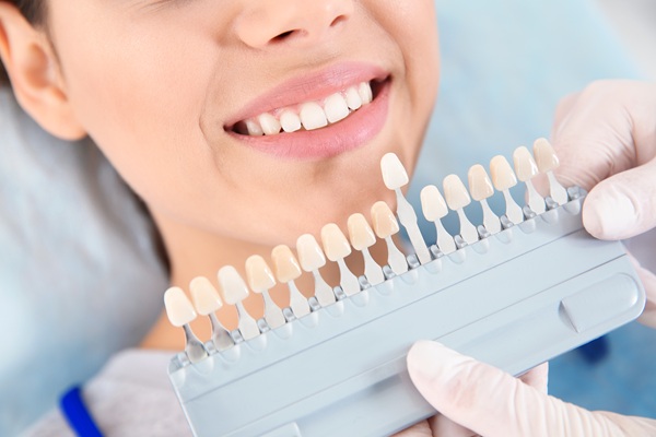 Dental Veneers As Part Of A Smile Makeover